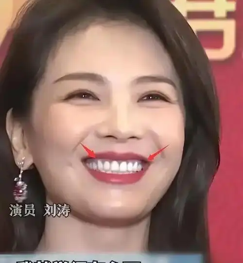 刘涛又上热搜一笑牙齿全变成了蓝色网友几百万的蓝牙