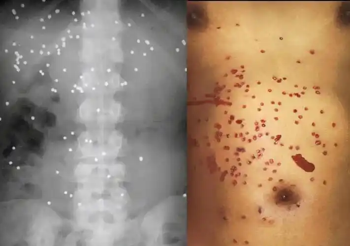 霰弹枪:游戏里唯唯诺诺,现实中重拳出击_子弹