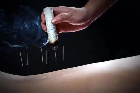 针灸八卦针的体会