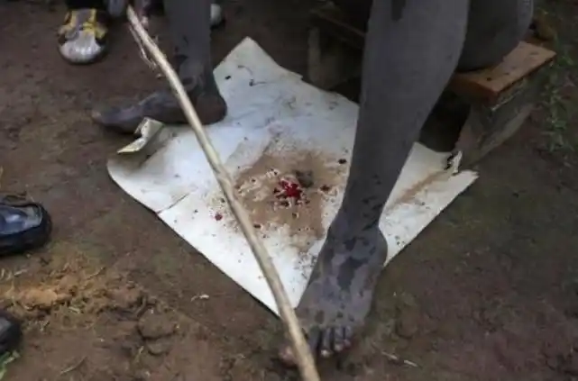 割礼是什么意思女性目的女性割礼的解释和目的