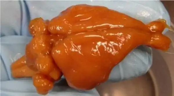 图1. "稳定乙醛"冷冻保存技术保存的兔脑(source:newsweek)