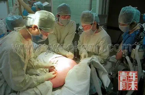 整容手术现场