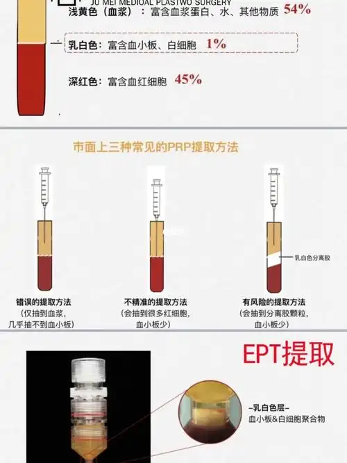 什么是"高潮针"_聚美整形美容攻略_美妆_医美整形