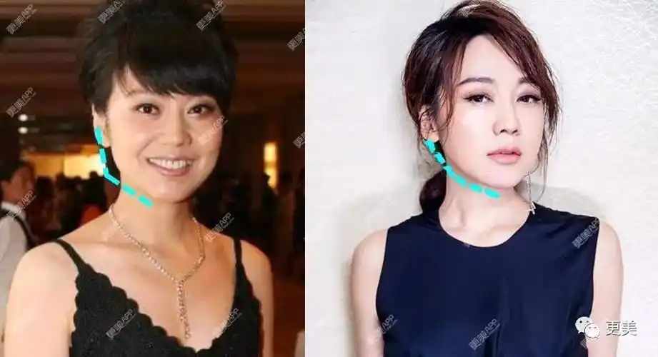 46岁闫妮身材堪比郑爽除了身材脸也发生了变化