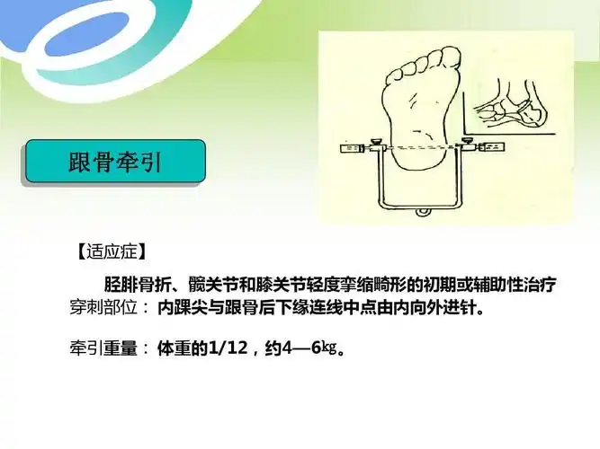 骨科牵引术的护理ppt