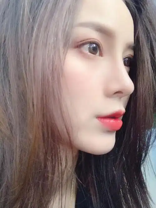 广州整形鼻部多项 漂亮的鼻子经得起镜_圈子-新氧美容整形