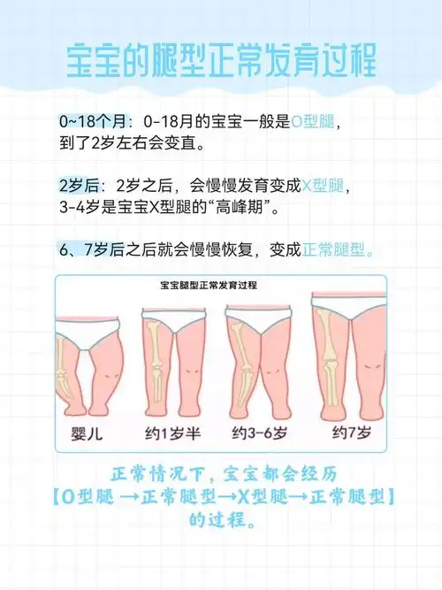 r
今天小编就给大家简单介绍下~

o型腿/罗圈腿/膝沫翻