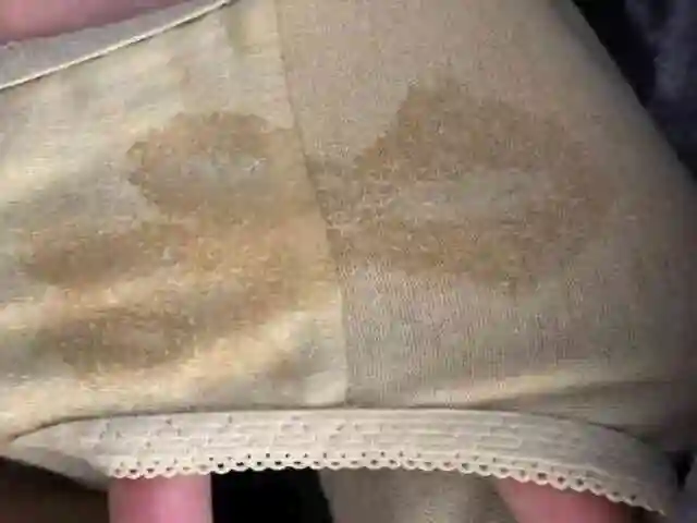 试管婴儿真的很痛苦吗多少钱 - 求医网