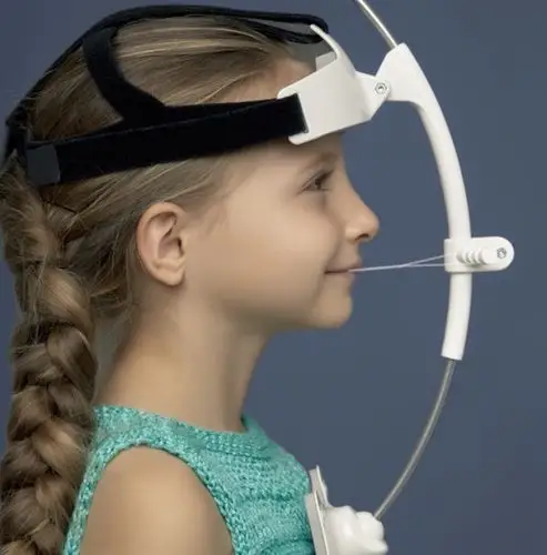 bow全球第一款不使用面部作为支抗的颌骨前方牵引装置