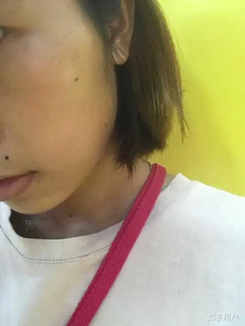 天生皮肤黑的人真的能通过后天保养或使用美白化妆品变白吗?