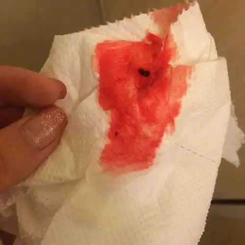 连续两三天这样,有鲜红的血.没来月经.怎么回事?好害怕.