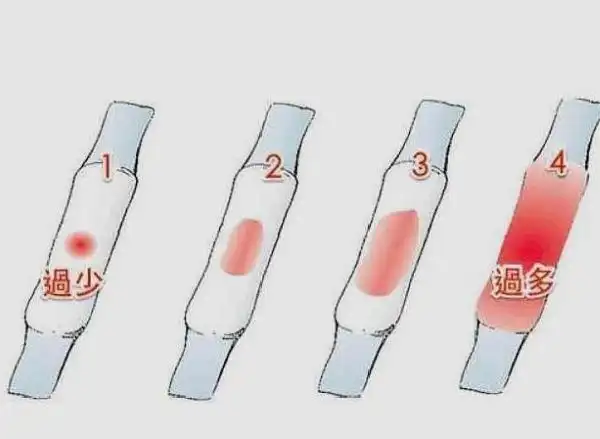 经过氧化后变为暗红色,如果月经颜色变成褐色,黑色带血块,还伴随有