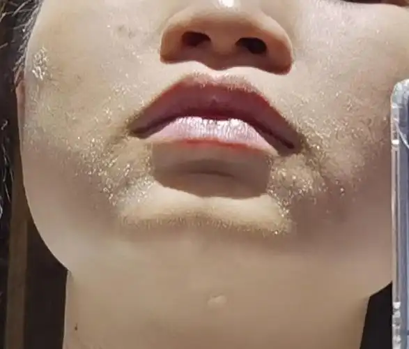 慎入大概是本组最严重的脸部起皮010101