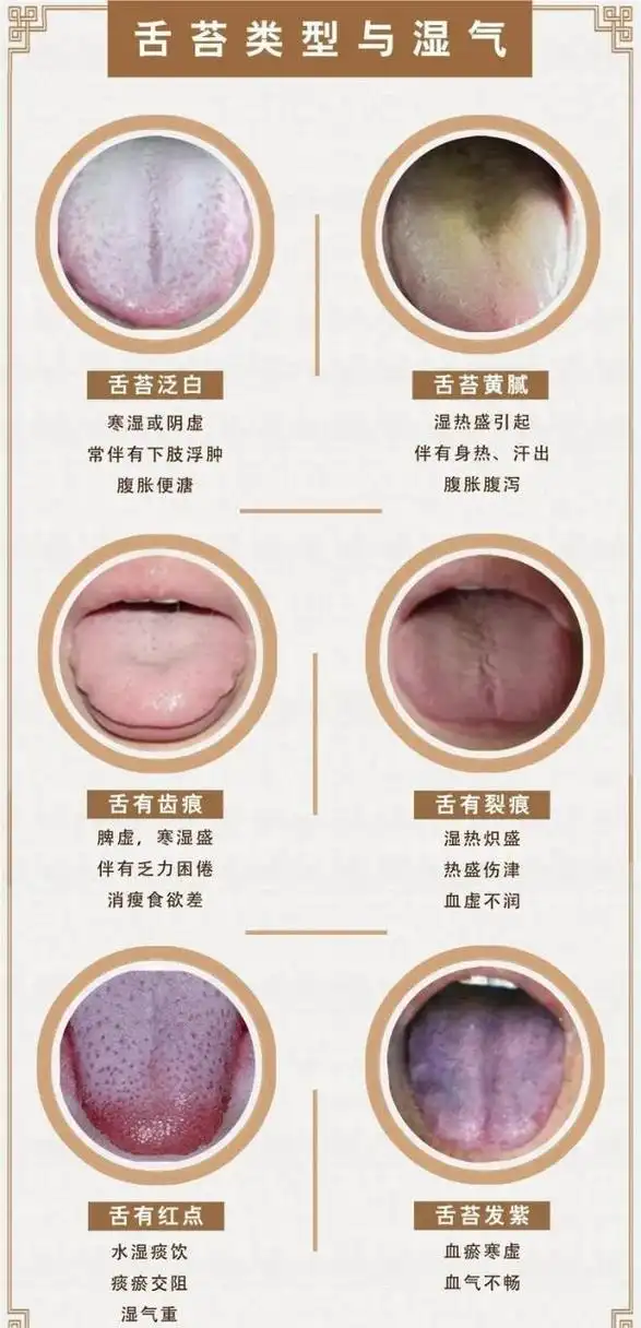 一张舌苔图简洁明了,让你知道自己属于哪种情况.