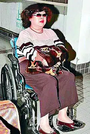 胆管手术引起并发症:56岁的沈殿霞惊传病重