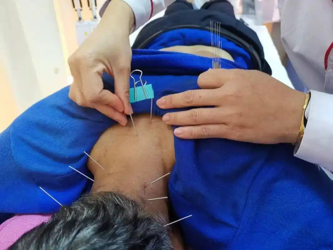 淞茂中医专家杞荣波针灸调治失眠顽疾70岁老人心怀感激写诗点赞