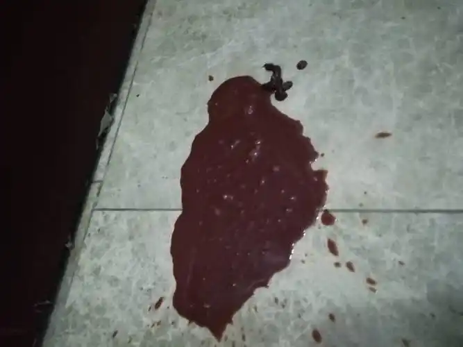 狗狗上吐下泻的.拉棕红色的血. 吐白色的液体怎么办.