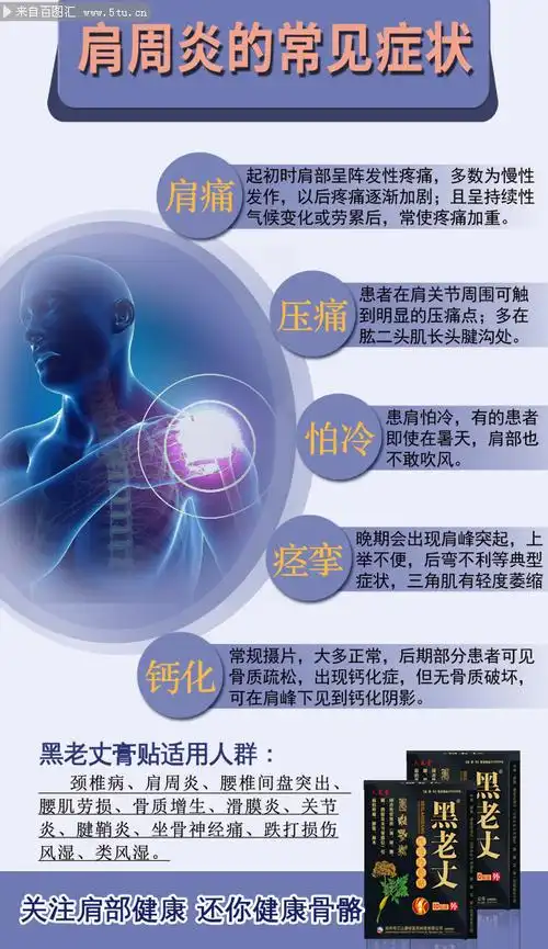 肩周炎症状图片素材