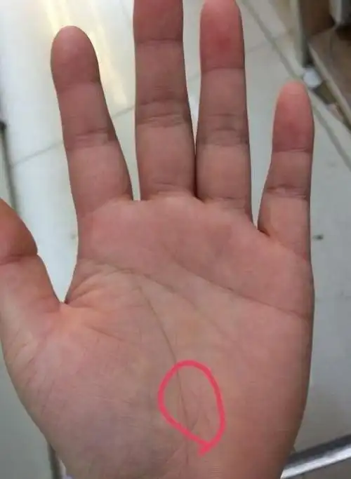 三角纹紧贴在生命线旁边如果三角纹靠近生命线,就意味着要注意内脏的