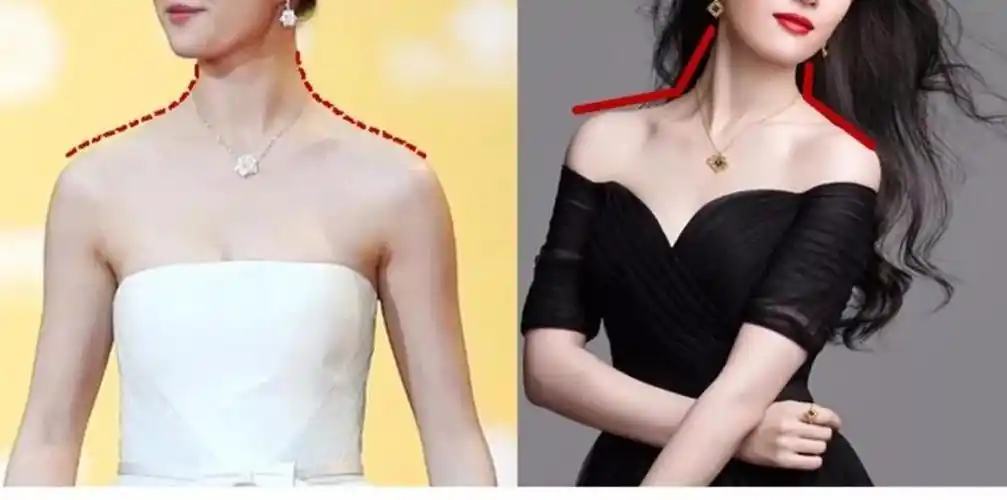 告别肥大肩厚了解一下