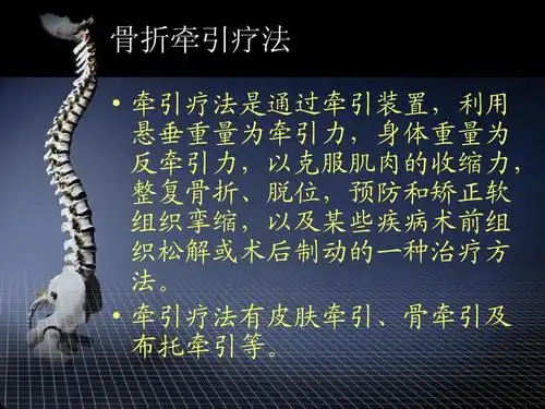 常见骨折牵引疗法及骨折并发症防治ppt