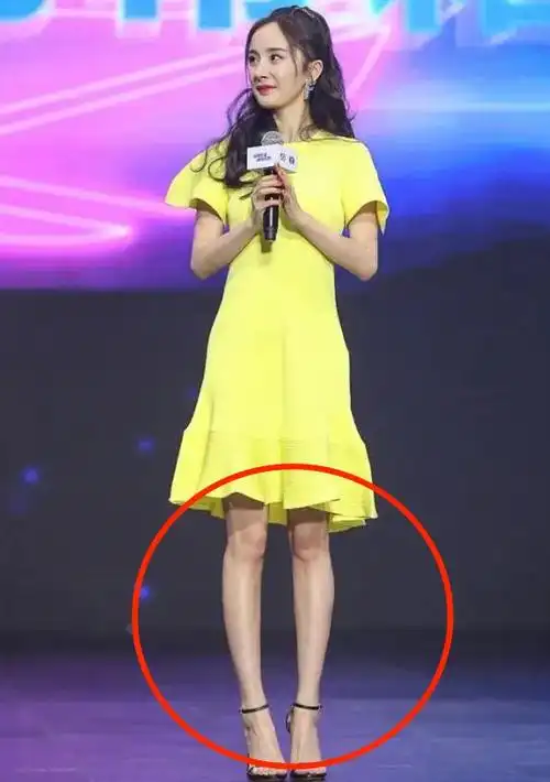 如今,网上也出现了很多教程,教大家怎样把腿练直,因此不少自认为腿弯