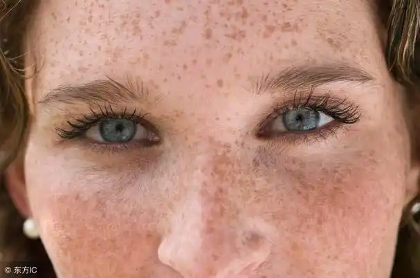 它是芝麻粒大小的,呈褐色,棕色斑点,表面平滑,不凸出.