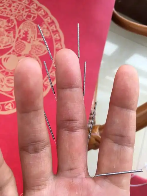 自己给自己扎手针