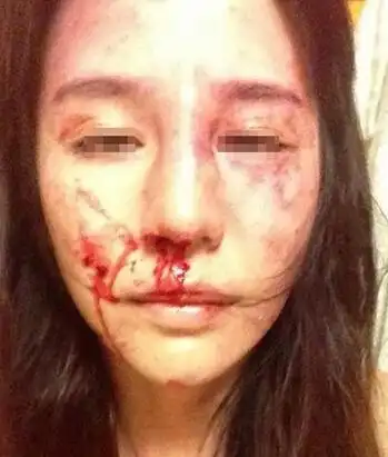 美女演员被家暴 家暴前后照片对比