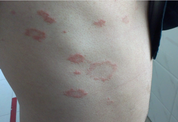 得肝癌前一个月,身体会有个最好认的征兆,需警惕