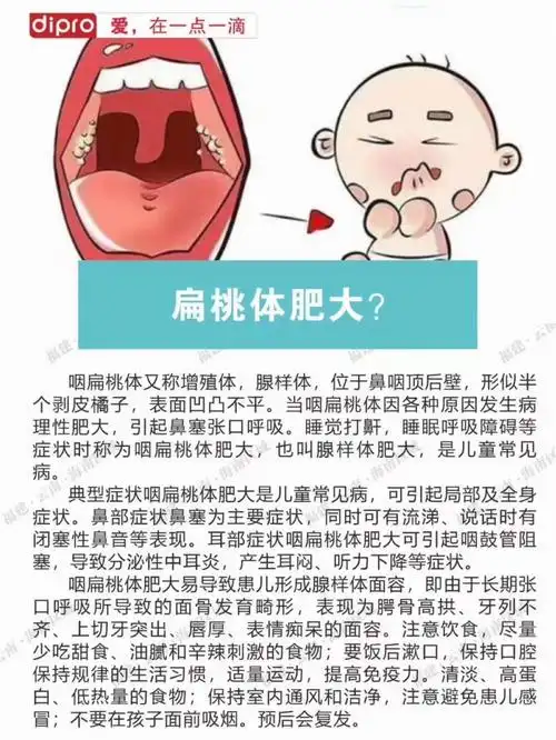 扁桃体肥大_健康生活_腺样体肥大_母婴_育儿经验