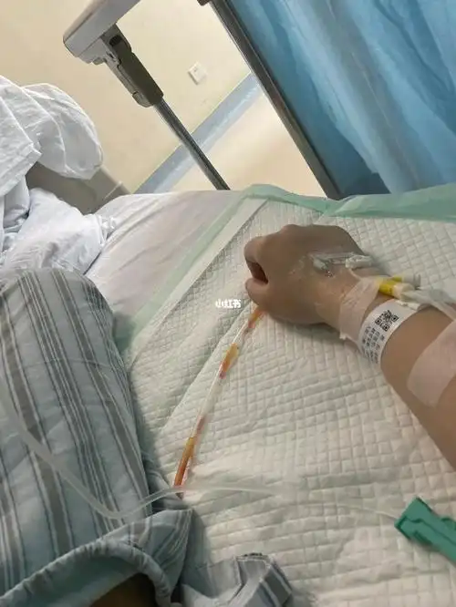 记录拖了一年多的阑尾炎手术(一)