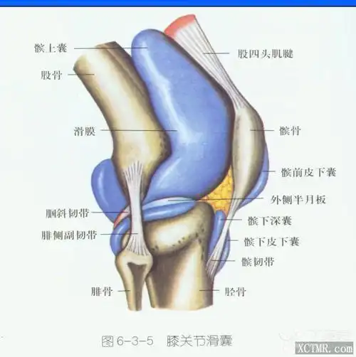 髌前滑囊由于创伤或感染而引起的滑膜充血,水肿,滑液增多,滑囊肿大者