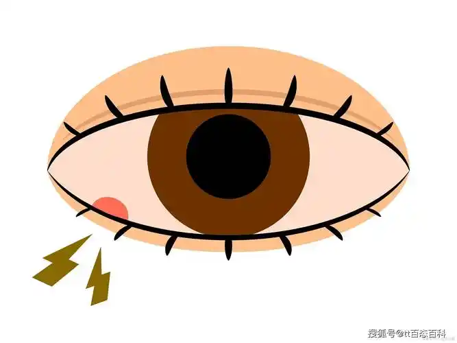 [百科]左眼跳财,右眼跳灾,真相是?