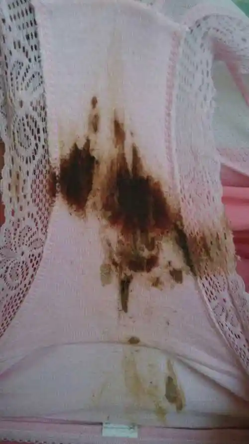 月经这个月没来原因有哪些 月经这个月没来是不是怀孕了 - 时尚美丽 -