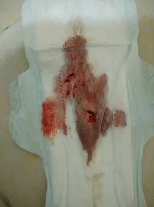 月经颜色正常米吗? - 准备怀孕 - 妈妈帮