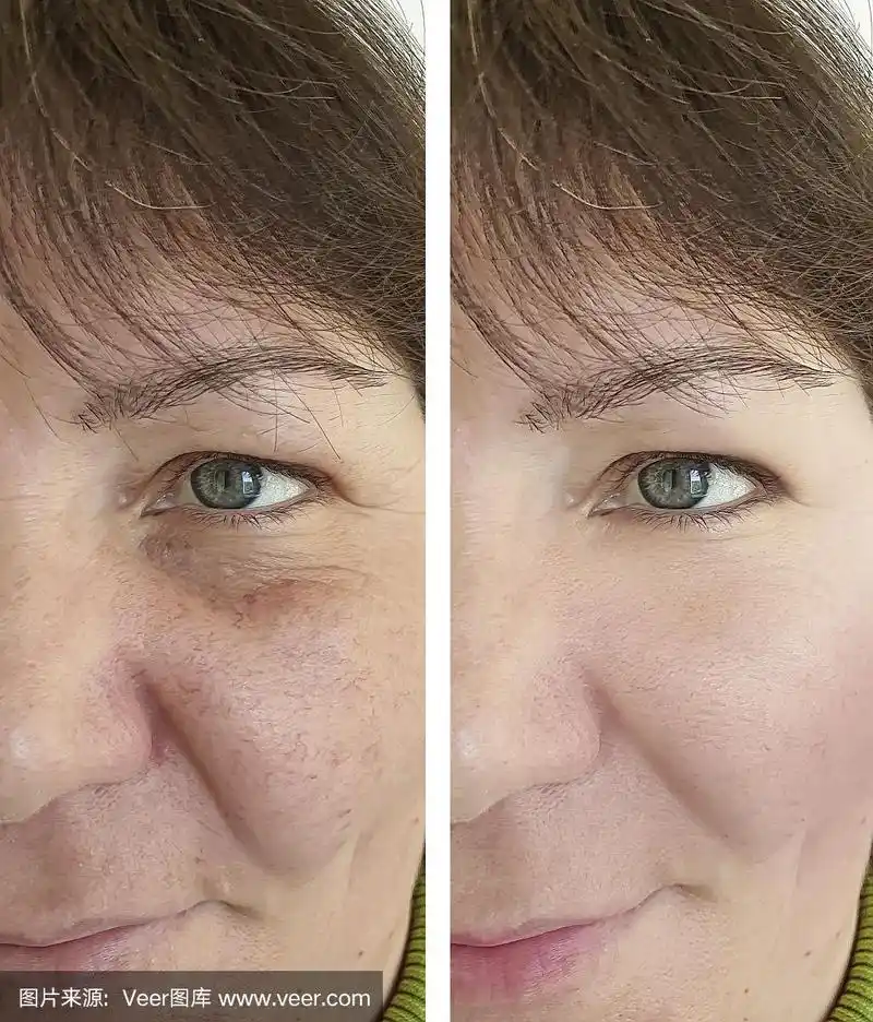 人的脸部,老年女人,皱纹,平衡折角灯,酸