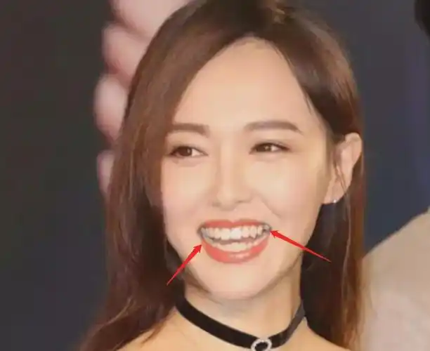又有明星乱整牙了宋祖儿门牙变吴宣仪同款张嘴还能看到色差