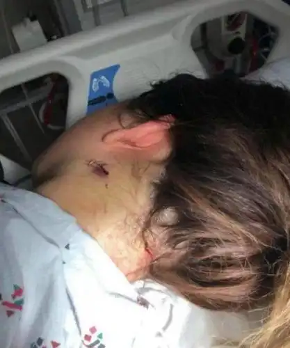 "老公家暴了我20分钟,我还是不愿意离开他"