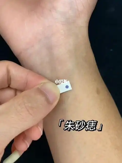 你可知道朱砂痣的含义