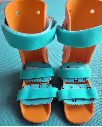 医院定做马蹄足石膏后内八外八婴儿童矫正鞋丹尼斯布朗鞋支具