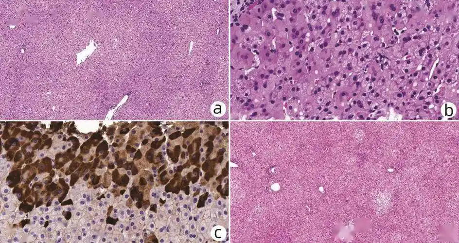 1完全正常肝组织形态结构