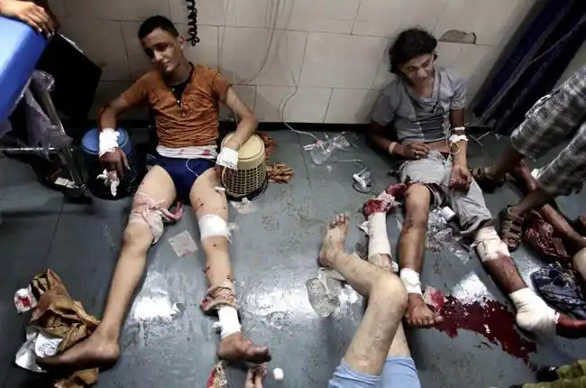 直视战争的血腥:以色列轰炸加沙场面触目惊心