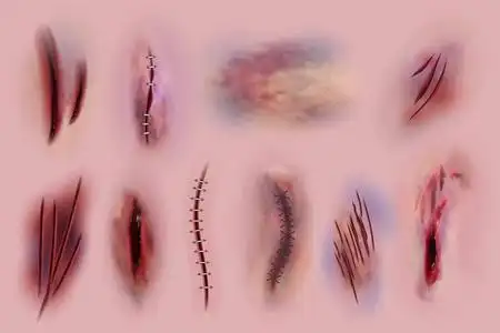 外伤缝合摆拍图片-外伤缝合摆拍素材-外伤缝合摆拍插画-摄图新视界