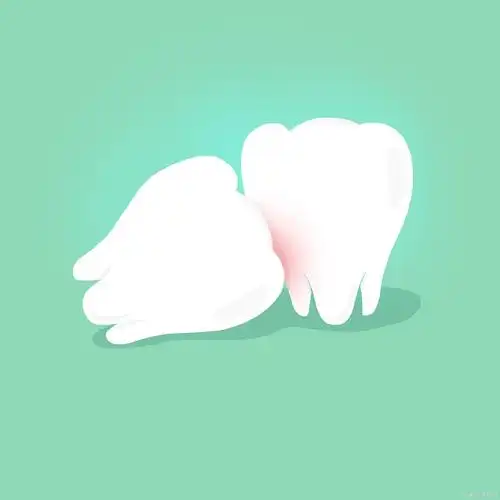 我的智齿长得是比较麻烦的,首先是横向生长,随着智齿的发育,逐步抵住