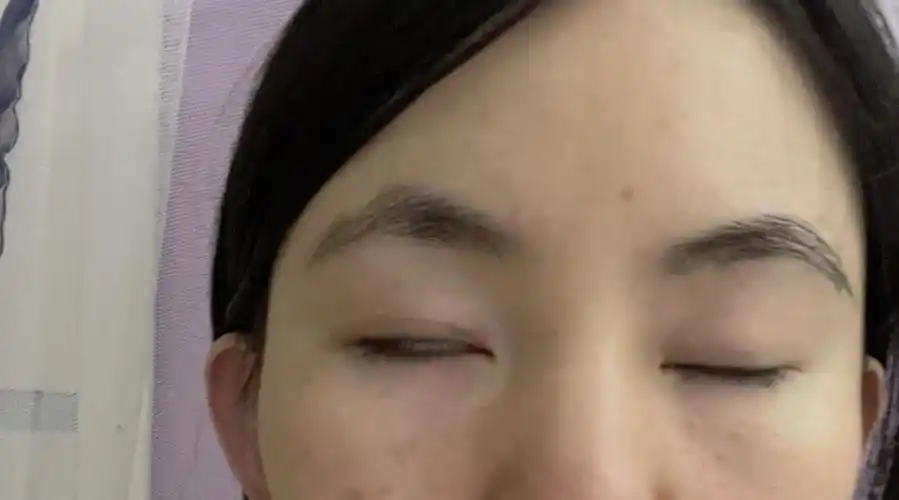 怀孕5个月面瘫症状