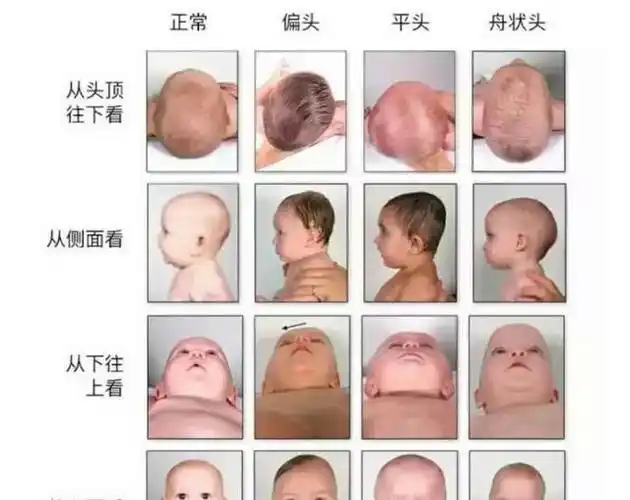 宝宝"头型"决定未来身高?并非乱说,这种头型往往不会矮