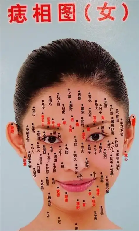 脸部痣吉凶大全图解女性 女性脸部痣的含义 女性面部痣妨夫痣 女人