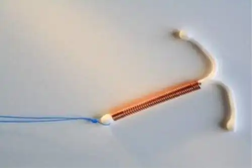 带环后多久可以同房带环会有副作用吗