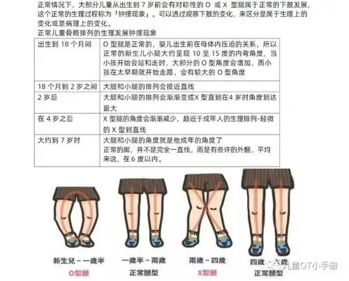 宝宝o型腿怎么办